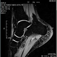 Orthopedic Imaging